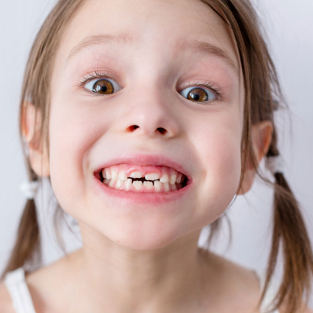 Ortodoncia infantil